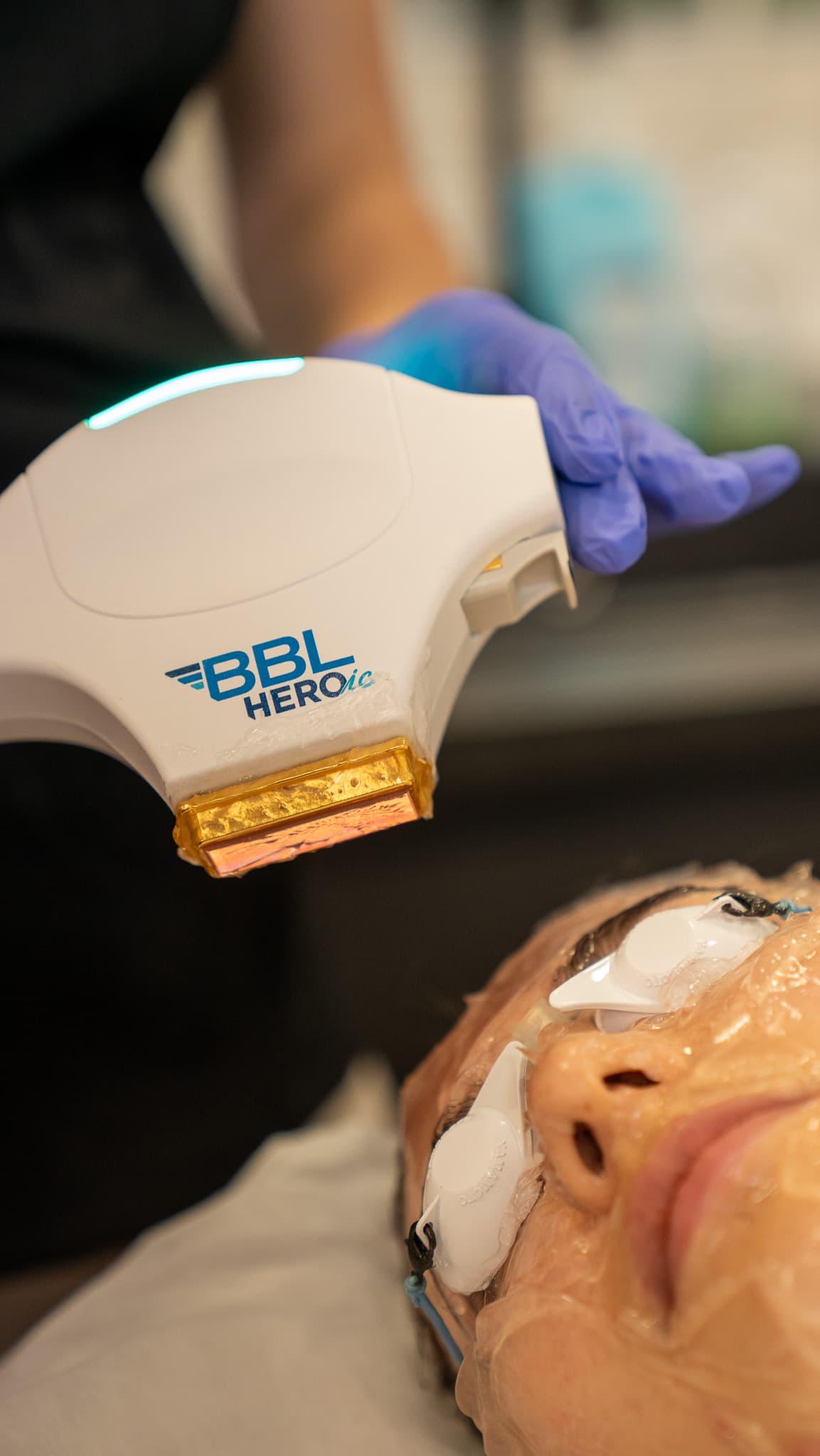 An INNODERM practitioner preparing a BBL treatment